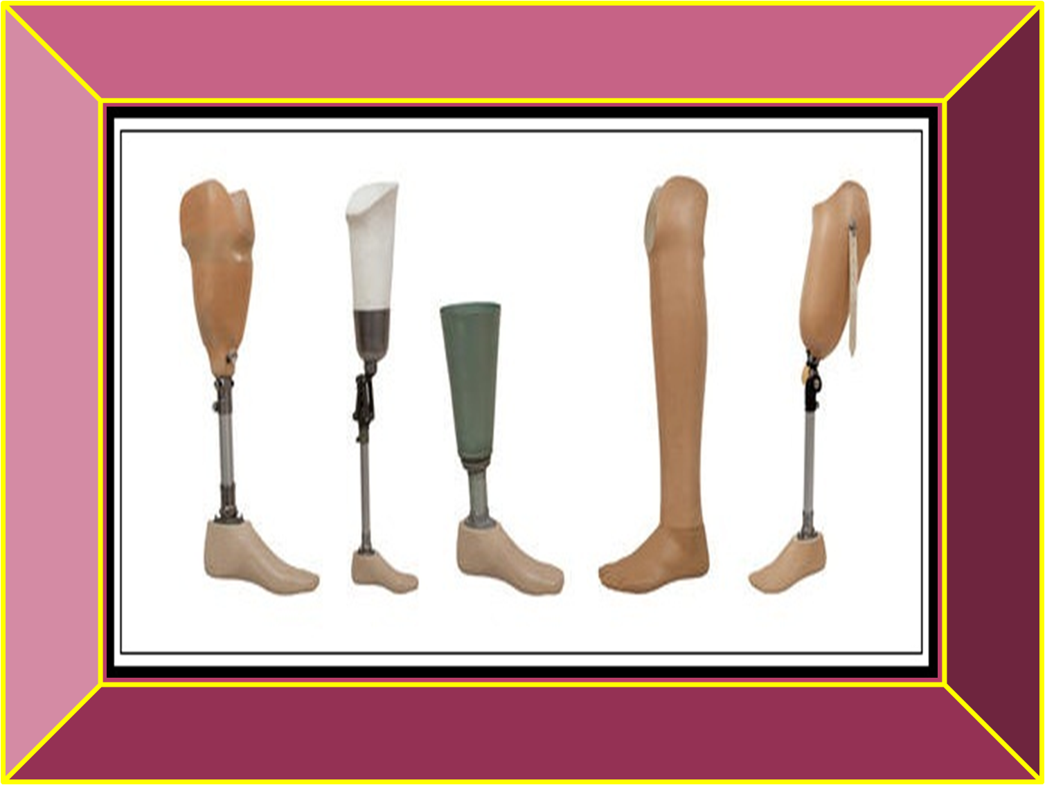 Prosthetics & Orthotics from My Care Artificial Limbs (Prosthesis)