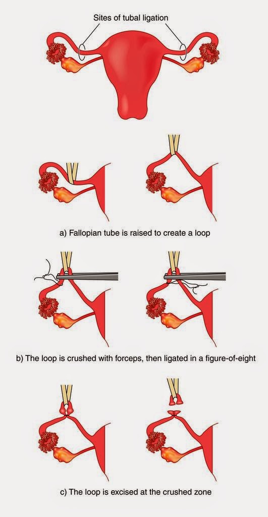 Obstetrics and Gynecology in Mexico at Hispano Americano Hospital