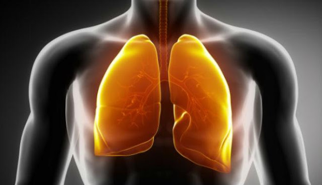 Beberapa Macam Jenis Penyakit Pada Paru-Paru Beberapa Macam Jenis Penyakit Pada Paru-Paru