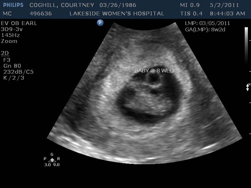 I am 7 weeks and 6 days pregnant!! I'm due on December 13, 2011 :D I am 7 weeks and 6 days pregnant!! I'm due on December 13, 2011 :D