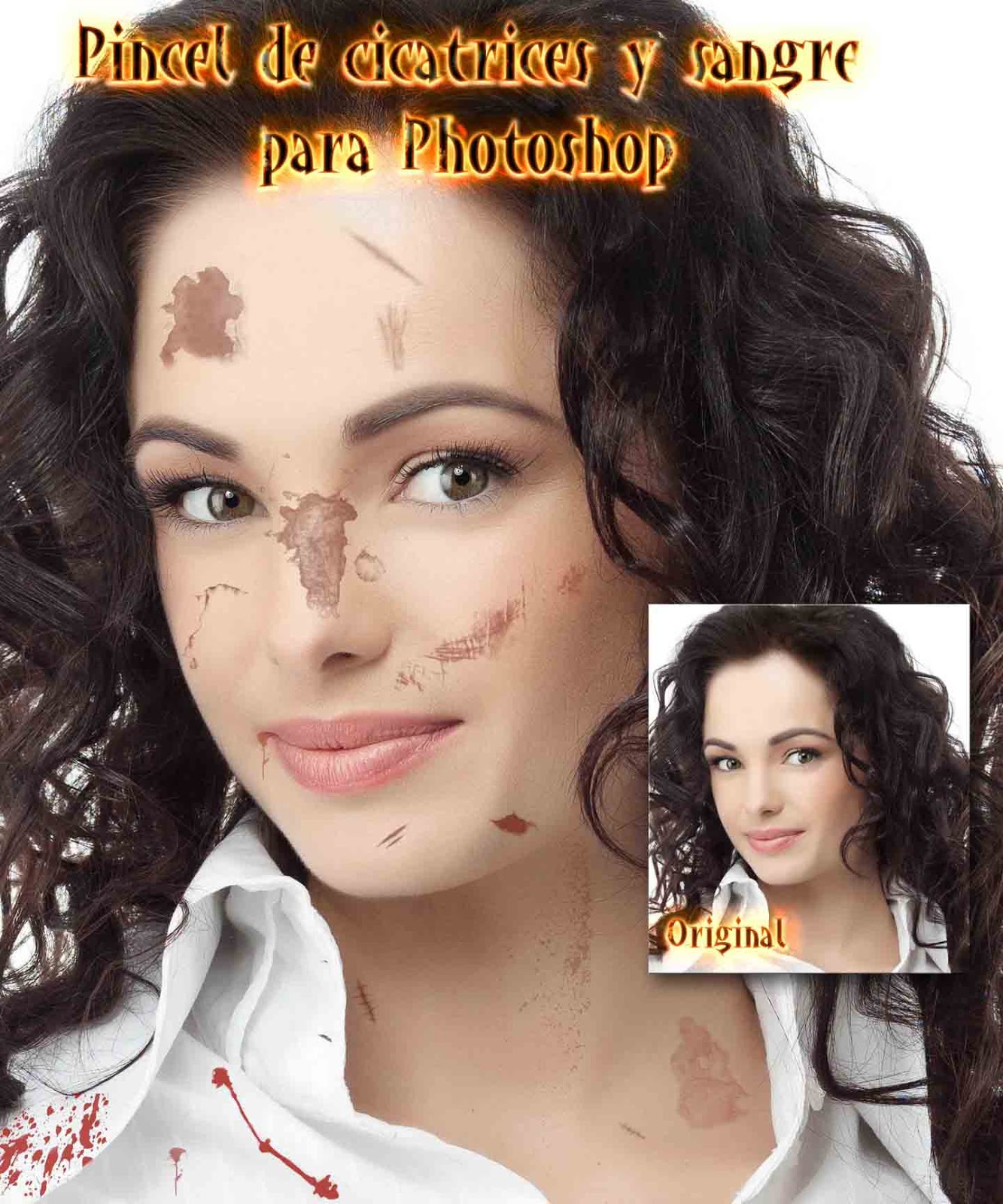 Sintético 90+ Foto Cicatrices De Operacion De Senos Fotos Actualizar