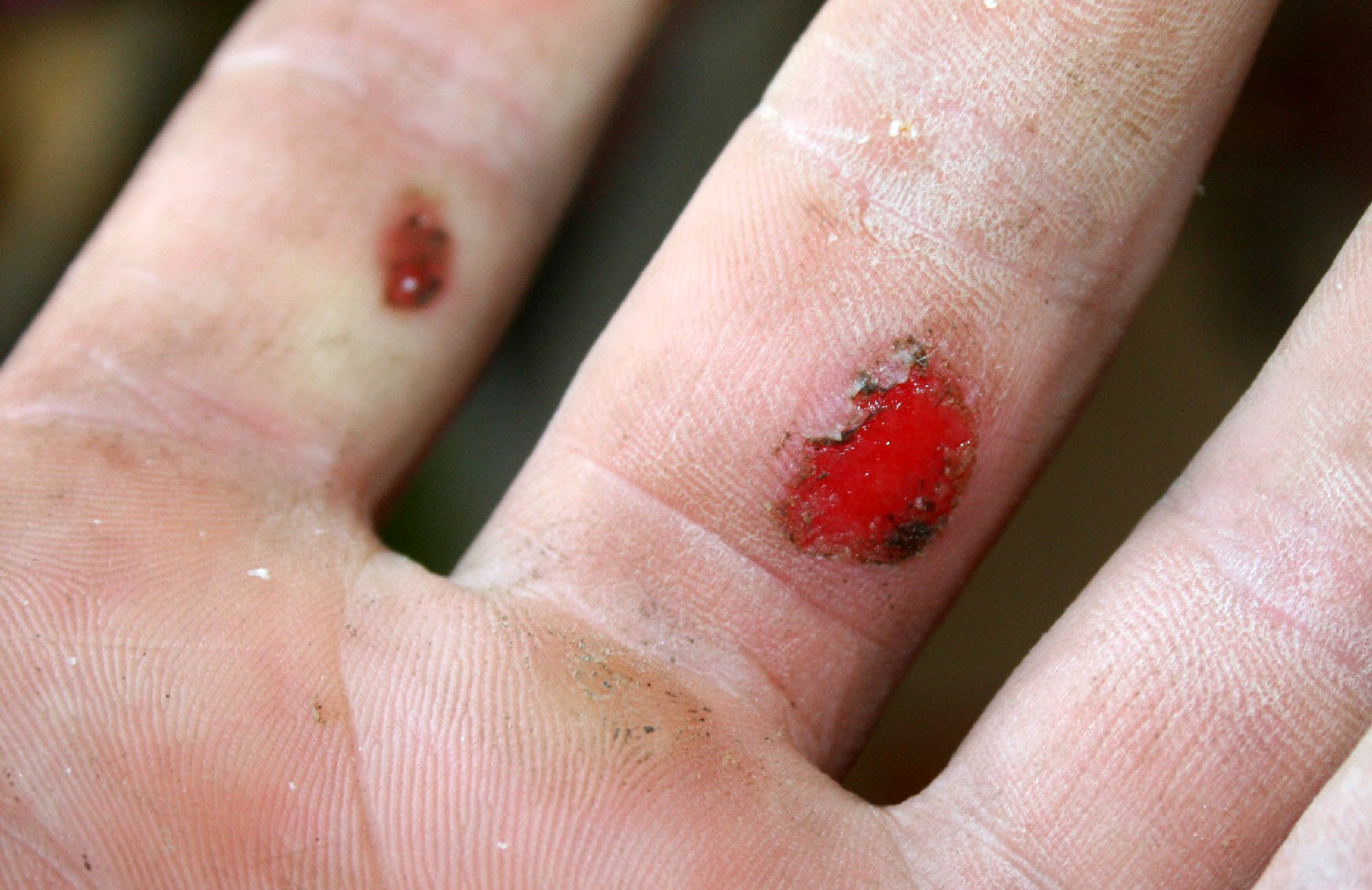 Damage to my hand Damage to my hand