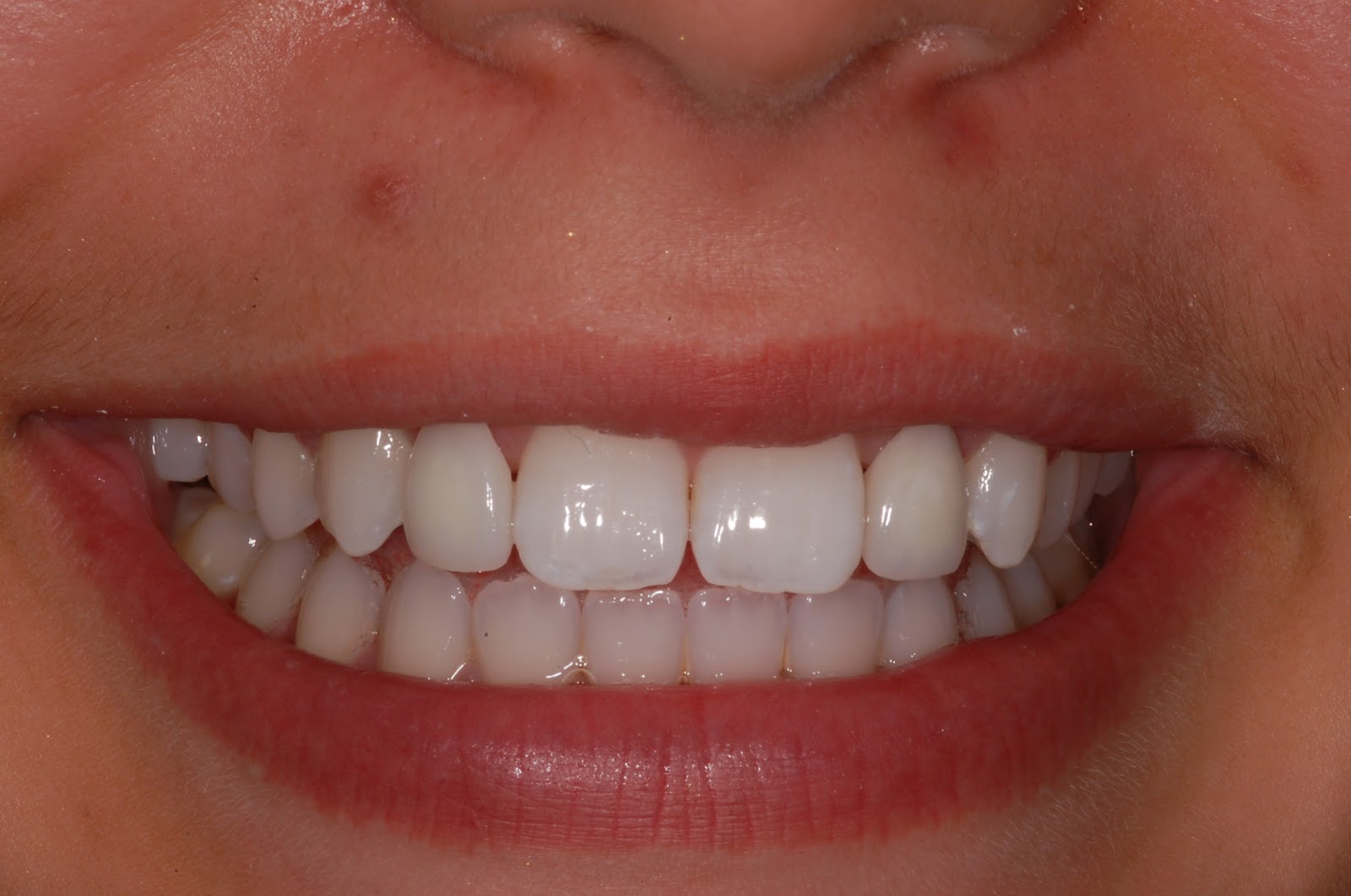 Permanent Maryland bridge