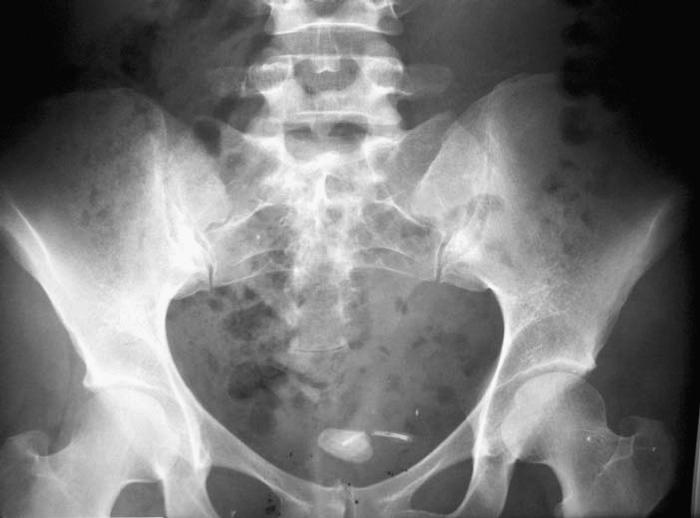 Técnicas Diagnósticas por Imagen: Radiografia