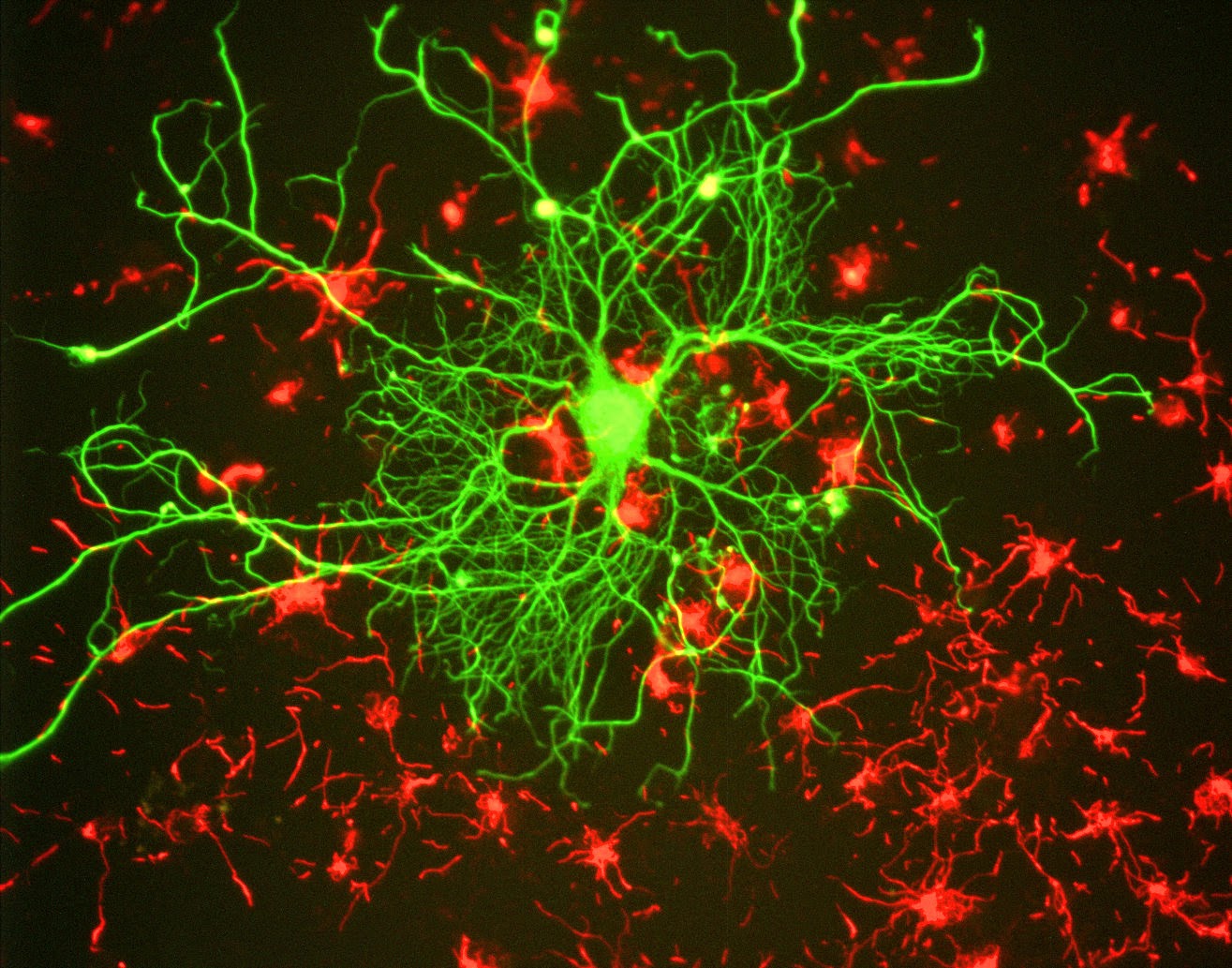 Pengertian dan Macam-Macam Sel Saraf (Neuron) Pengertian dan Macam-Macam Sel Saraf (Neuron)