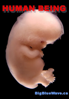 First trimester fetus