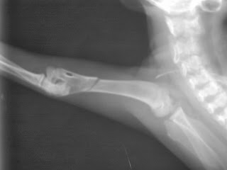 fracturas huesos largos fijacion externa fijador de Meynard