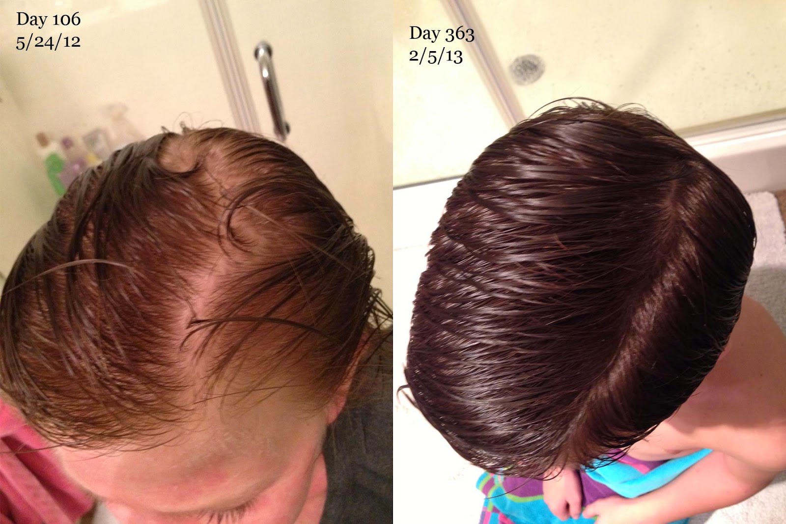 Black Castor Oil On Edges By Beauty Damned Hair Growth