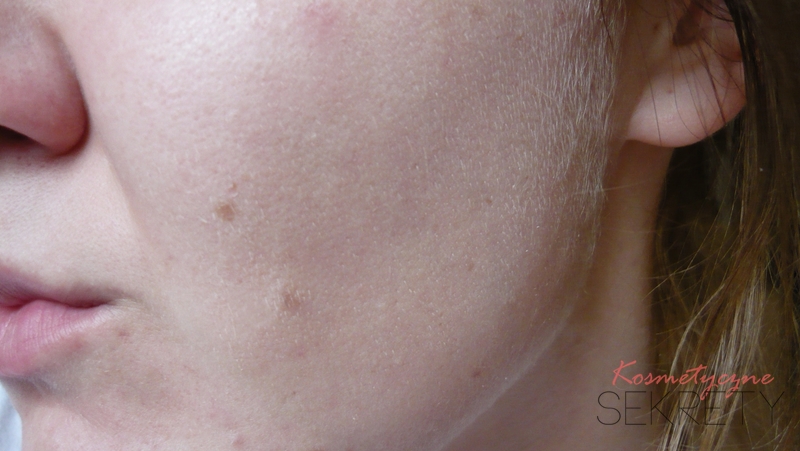 Kosmetyczne Sekrety Paula S Choice Skin Perfecting 2 Bha Liquid Exfoliant Zdjecia Przed I Po