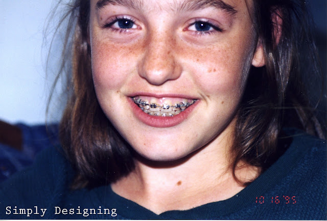 braces #ad #INVStraightTalk