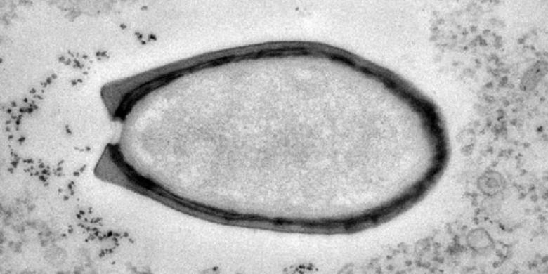 Ditemukan Virus Terbesar di Muka Bumi Ditemukan Virus Terbesar di Muka Bumi