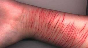 Sex injury pics #3