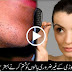 How Remove Unwanted Chin Hair - Great Tip By Dr Khurram
