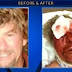 Today's brawl: 61-year-old man in critical condition after mob attack