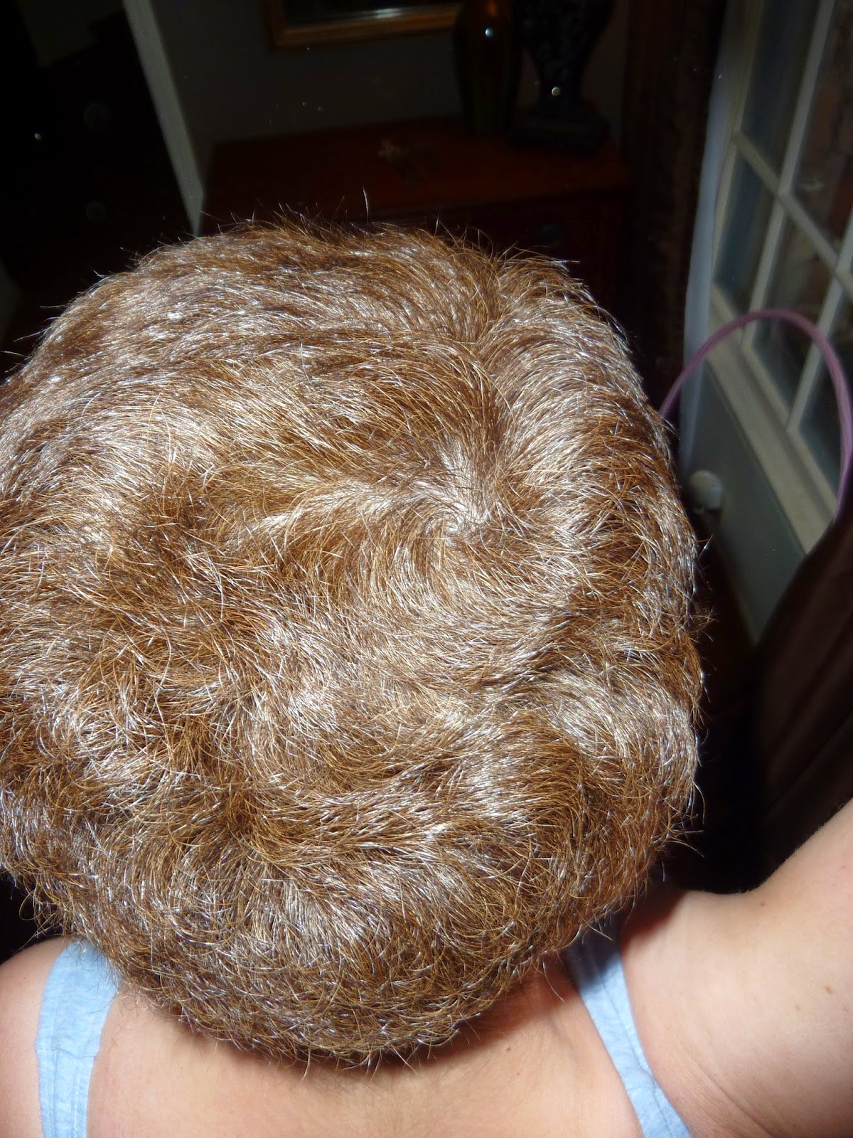 Anncredible: Hair Growth Progression after Chemo- Six Months with UPDATE!