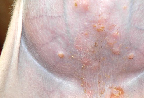Metronidazole For Dog Bite Metronidazole For Dog Bite