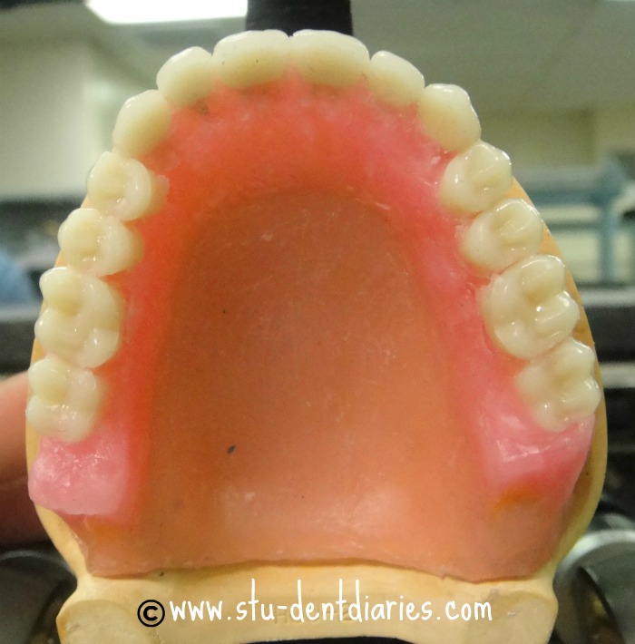 teeth setting
