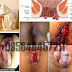 Obat Salep Nyeri Wasir Selain Borraginol thumbnail