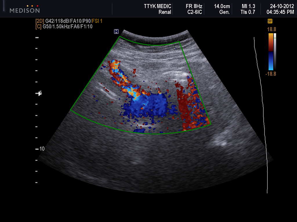 What do colors on gallbladder ultrasound mean The Meaning Of Color