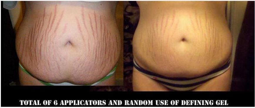 arlo olive enter a drawing to win a free it works wrap it works wraps for stretch marks