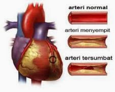 obat herbal jantung