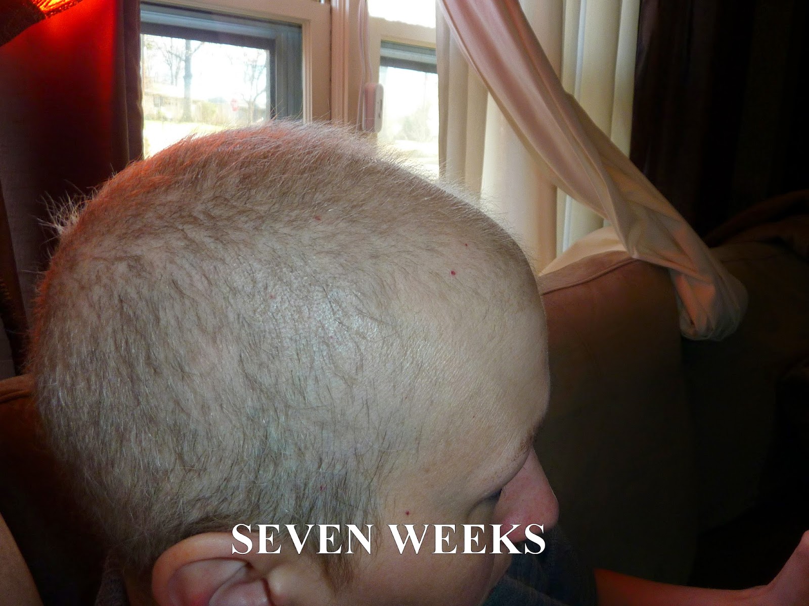 Anncredible: Hair Growth Progression after Chemo- Six Months with UPDATE!