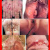 Obat Gatal dan Keluar Bintik Merah di Kelamin thumbnail