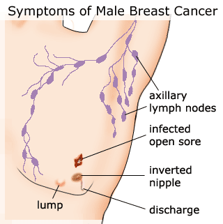 Breast Cancer Tattoos Breast Cancer Tattoos