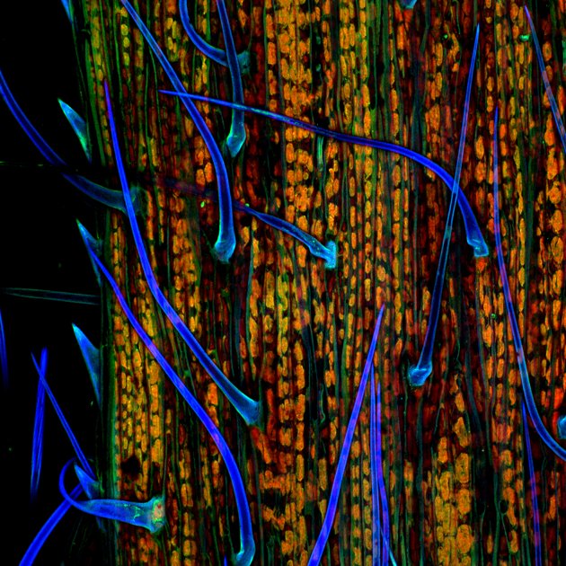Microscopic Photography International Competition 2011 Oddetorium
