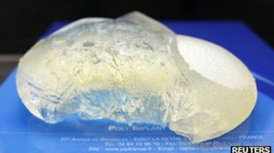 implan payudara pip - Poly Implant Prothese