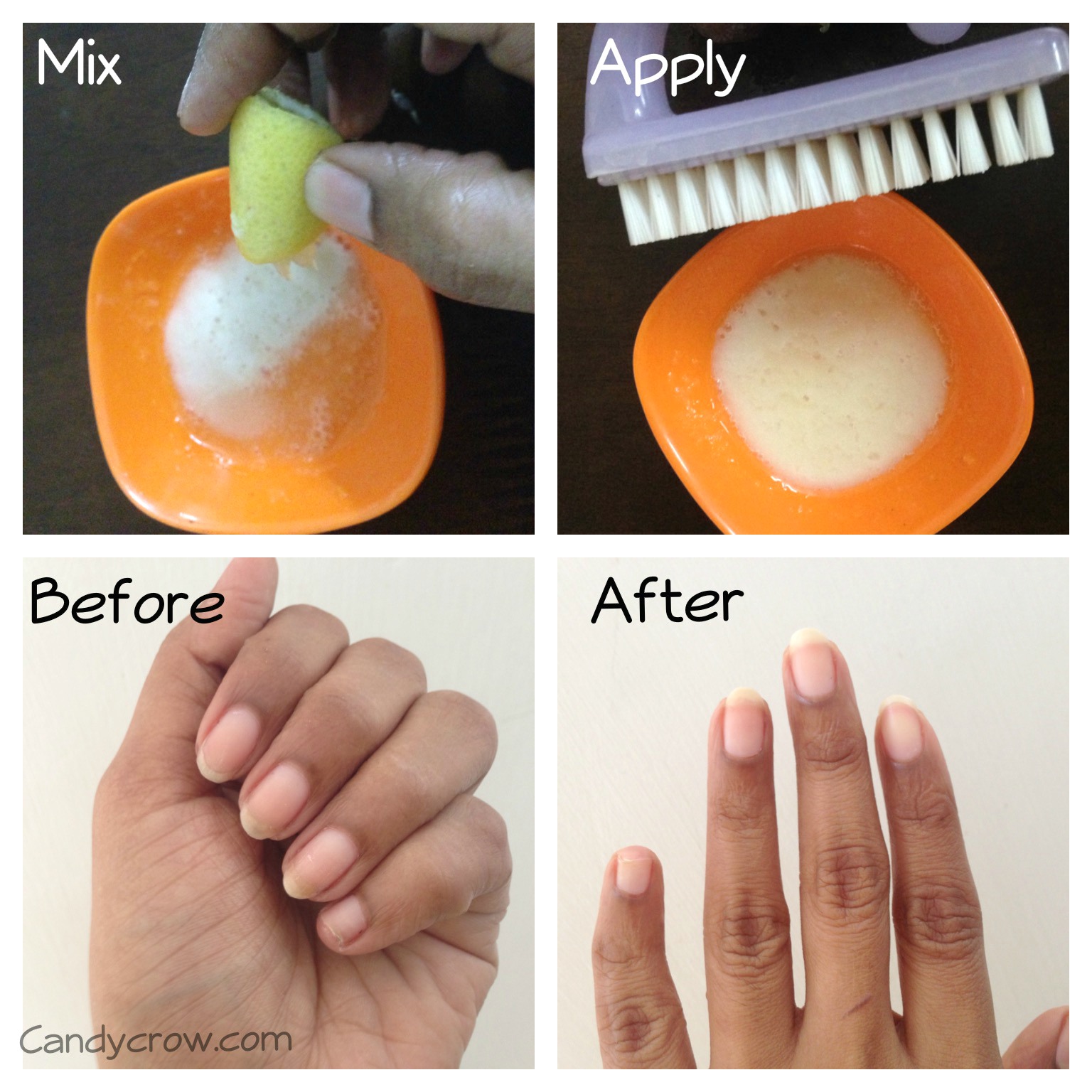 How to Get Rid of Yellow Nails Quickly? - Candy Crow