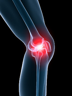 How to strap a knee and treat Knee Pain and Meniscus Tears