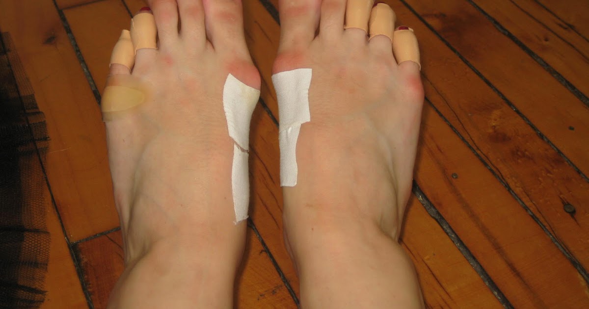 Ballet in The Big Apple Salonpas, IcyHot, Ice pack, Ace bandage, Toe