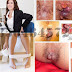 Harga Ambeclear Obat Wasir di Toko Online thumbnail