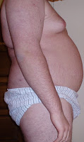358px-ObeseManSideView.jpg