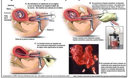 1. Deducción por maternidad para madres trabajadoras