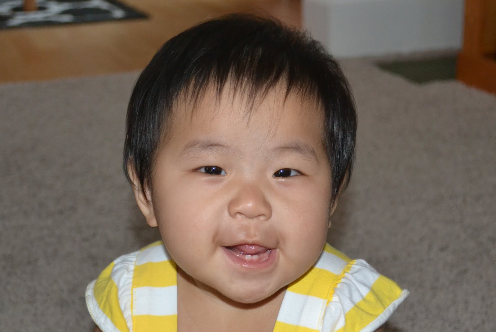 Flat Flat Nasal Bridge