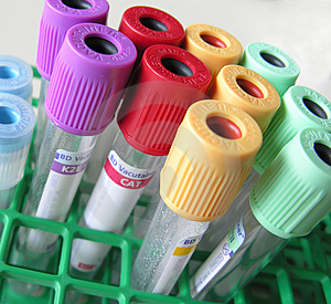 Exames de sangue vdrl