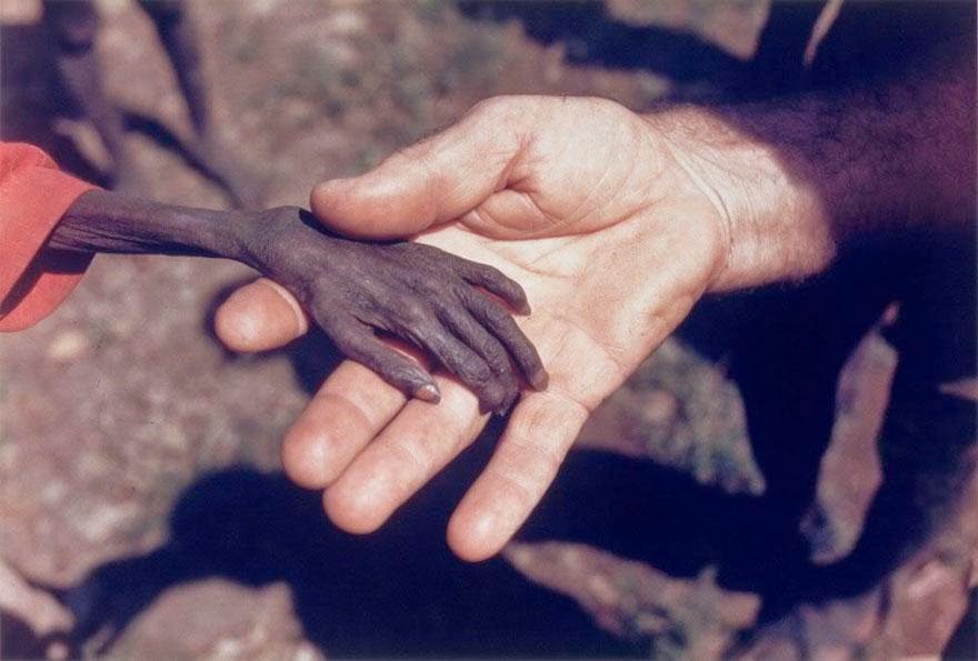30+of+the+most+powerful+images+ever+-+Starving+boy+and+missionary.jpg