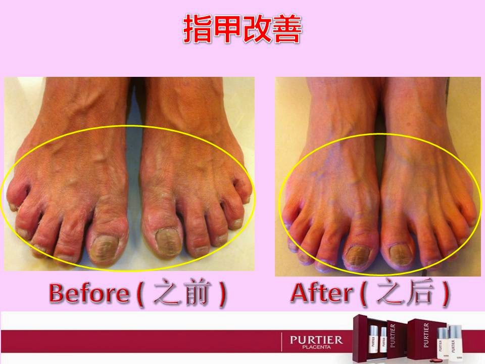 SKIN & NAILS IMPROVEMENT