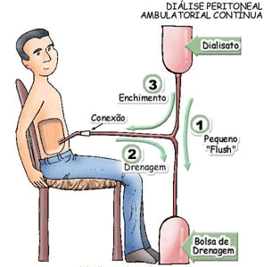 INSUFICIENCIA RENAL AGUDA CRONICA PEDIATRIA insuficiencia renal aguda cronica pediatria: