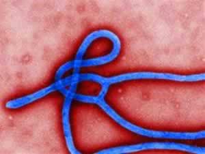 С вирусом Эбола будет бороться робот