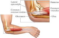 Tennis Elbow | Golfers Elbow | Epicondylitis | Treatment of Elbow Pain