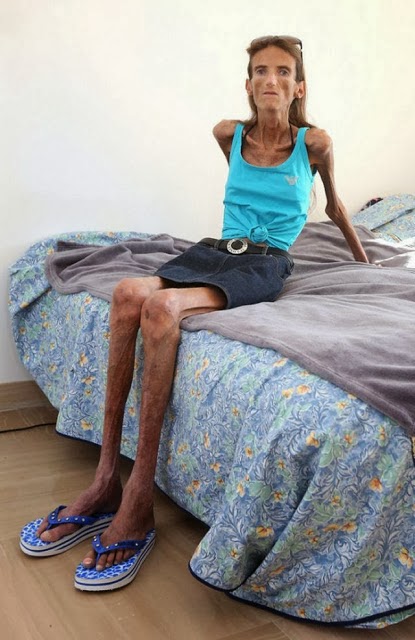 http://www.srvaquinha.com/2014/01/mundo-animel-em-fotos-bizarras.html