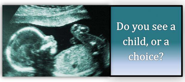 Banner: Ultrasound of baby. Asks do you see a child or a choice?