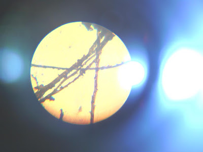 Chemtrail-Critter 1 - Morgellons Disease 'Synthetic Exo-Biology' - Human DNA-Geo-Engendered Better Bankster Cash-Cows
