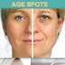 15 Useful Home Remedies for Removing Age Spots