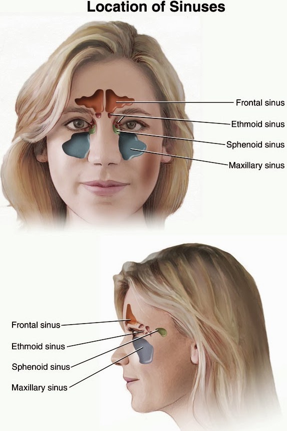 sinusitis nasal turbinate hypertrophy sinus cyst retention sphenoid treatments swelling sinuses irritation homeopathy congestion
