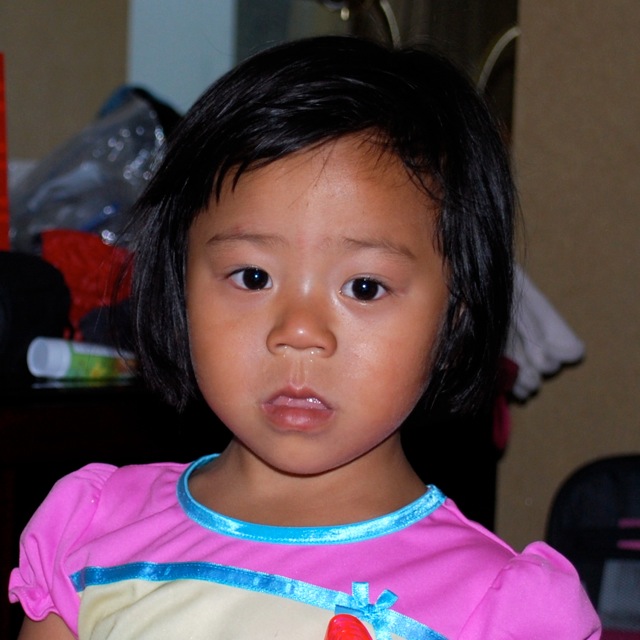 Bring my sons from afar... Before and After Tongue Reduction Surgery