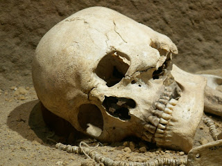 Human Skull